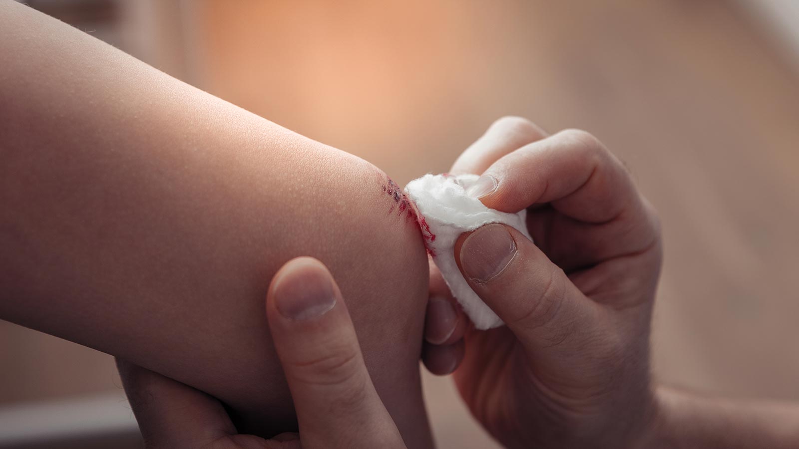 Qué antisepticos utilizar